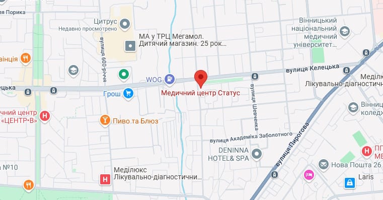 Вінниця Статус