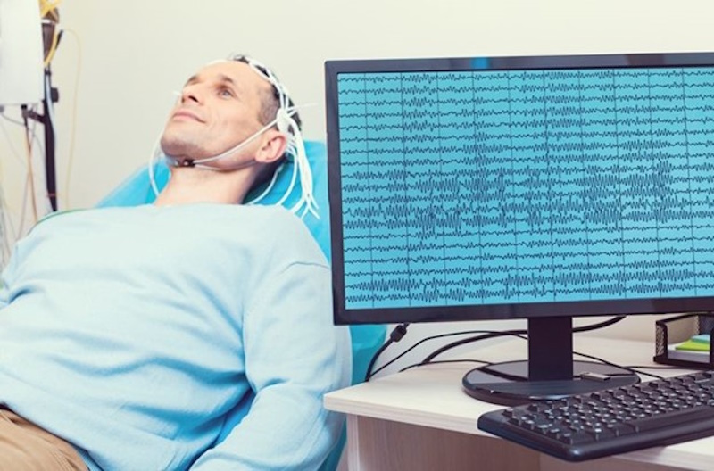 электроэнцефалограм