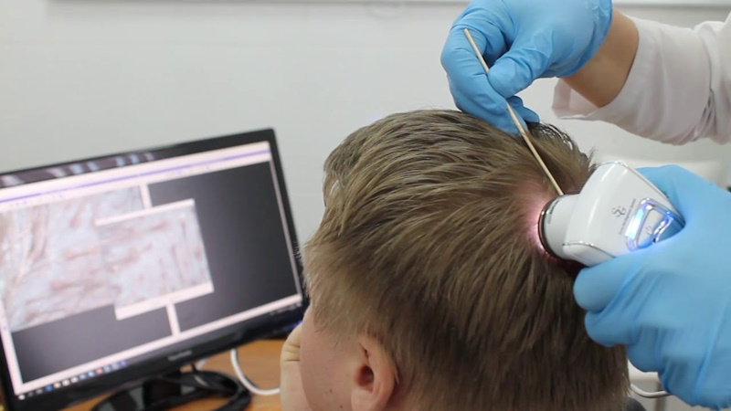 Лікар - трихолог